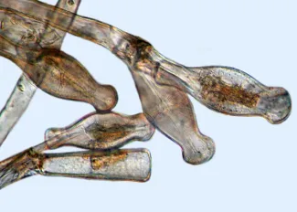 Didymo on mucilaginous stalks